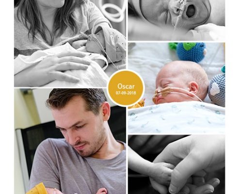 Oscar prematuur geboren met 25 weken en 6 dagen, sonde, vroeggeboorte, pre-eclampsie, UMCG, spoedkeizersnede, CPAP