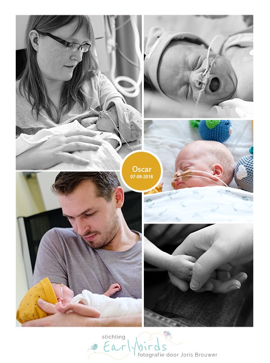 Oscar prematuur geboren met 25 weken en 6 dagen, sonde, vroeggeboorte, pre-eclampsie, UMCG, spoedkeizersnede, CPAP
