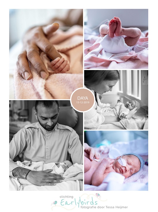 Daya prematuur geboren met 32 weken, stuitligging, neonatologie, couveuse