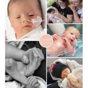 Eviannne prematuur geboren met 34 weken, Beatrix ziekenhuis, couveuse, sonde, badderen