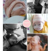 Hayley prematuur geboren met 28 weken, Tjongerschans, sonde, badderen