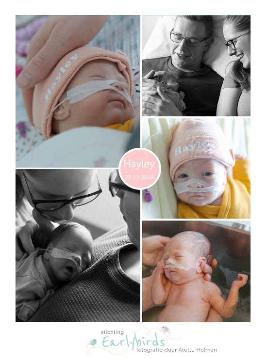 Hayley prematuur geboren met 28 weken, Tjongerschans, sonde, badderen