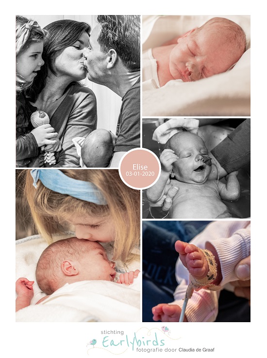 Elise prematuur geboren met 31 weken en 1 dag, gebroken vliezen, Rijnstate, longrijping, couveuse