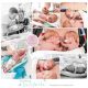 Lynn & Lois prematuur geboren met 25 weken, LUMC, tweeling, spoedkeizersnede, buidelen, sonde