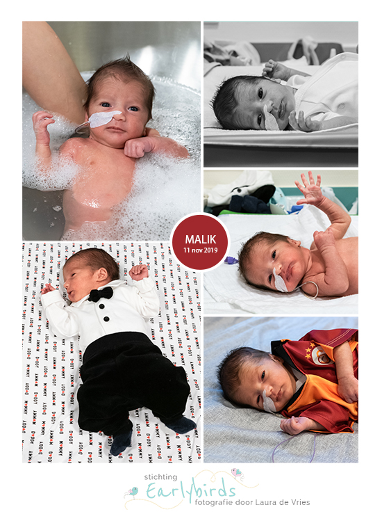 Malik prematuur geboren met 33 weken, zwangerschapsvergiftiging, Meander MC, badderen, sonde