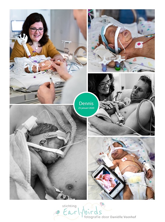 Dennis prematuur geboren met 25 weken en 6 dagen, tweeling, VUMC, longrijping, weeenremmers, NICU, CPAP, buidelen, sonde