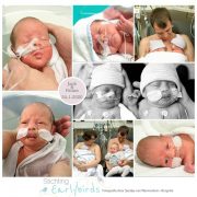 Jack & Feline premauur geboren met 31 weken, Nij Smellinghe, tweeling, couveuse, buidelen, badderen, sonde