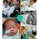 Mar-Gevinio prematuur geboren met 30 weken, Nij Smellinghe, gebrokenvliezen, borstvoeding, buidelen, sonde