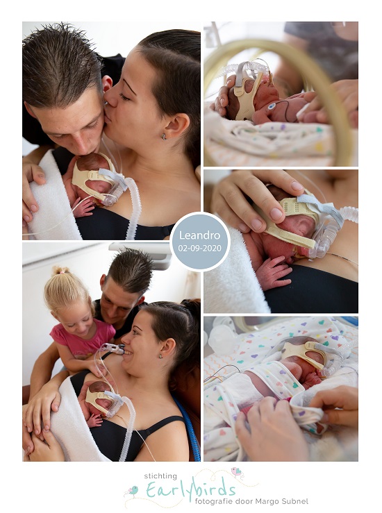 Leandro prematuur geboren met 25 weken en 5 dagen, placenta previa totalis, longrijping, weeenremmers, CTG, MMC, CPAP, sonde, buidelen