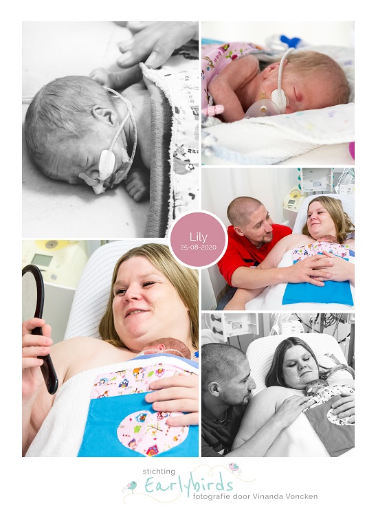 Lily prematuur geboren met 29 weken,, Maastricht UMC, buidelen, sonde, snorretje
