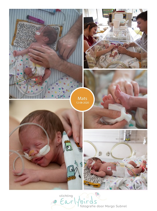 Mats prematuur geboren met 29 weken en 3 dagen, CPAP, high flow, St. Anna, MMC Veldhoven, couveuse