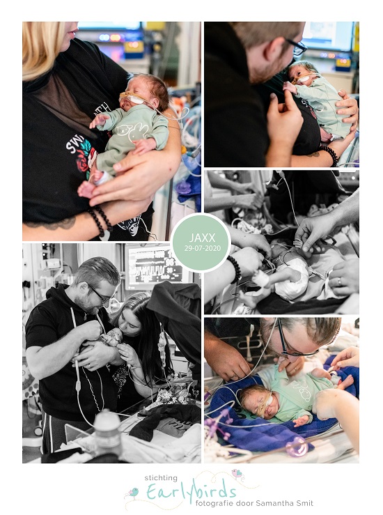 Jaxx prematuur geboren met 26 weken, Sophia Kinderziekenhuis, buidelen, sonde