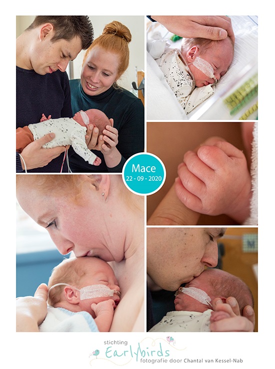 Mace prematuur geboren met 28 weken en 6 dagen, Gelderse Vallei, hoge bloeddruk, zwangerschapsvergiftiging, Hellp, Radboud, keizersede, borstvoeding, buidelen, sonde