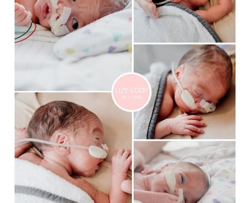 Lize-Lody prematuur geboren met 29 weken, VUMC, gebroken vliezen, sonde, buidelen