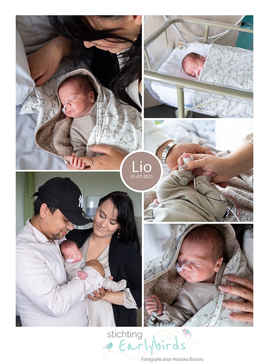 Lio prematuur geboren met 33 weken